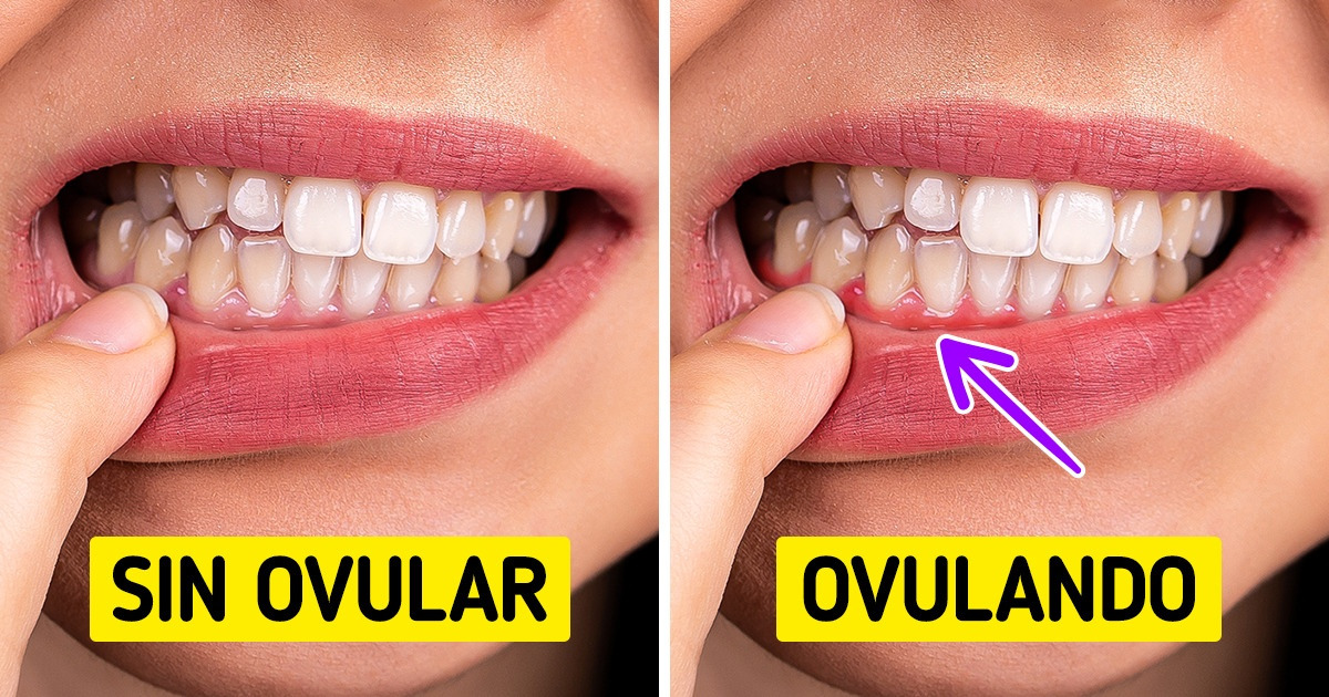 La salud dental de las mujeres y su relación con los cambios hormonales
