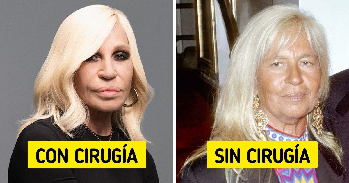 Cómo se verían 10 famosas si hubieran envejecido de forma natural, sin hacerse cirugía plástica Cómo se verían 10 famosas si hubieran envejecido de forma natural, sin hacerse cirugía plástica