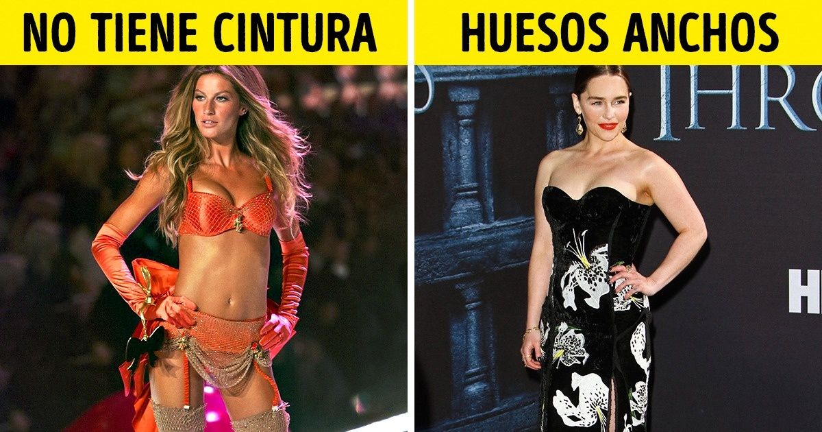 7 Celebridades que convirtieron sus deficiencias en su mejor atributo