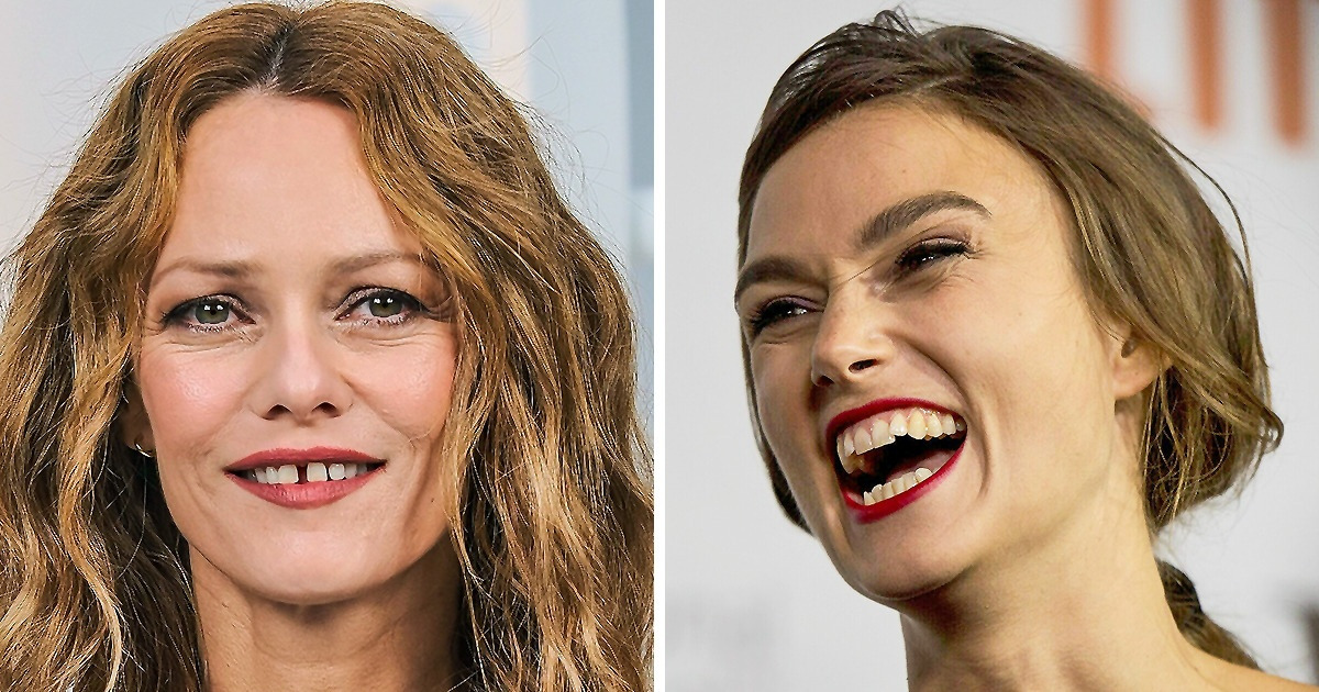 16 Celebrities Who Embraced Their Perfectly Flawed Smiles