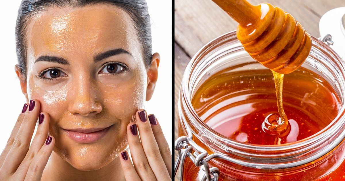 Tipos de acné y formas efectivas para tratarlo Tipos de acné y formas efectivas para tratarlo