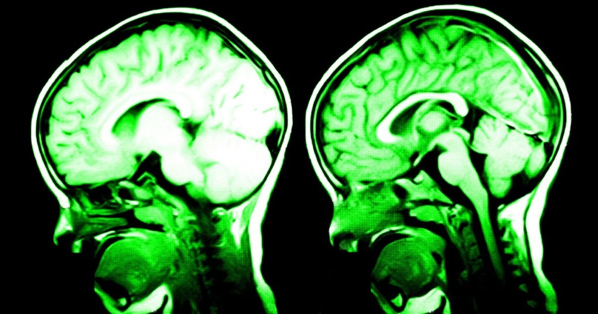 7 Cosas que cambian físicamente tu cerebro