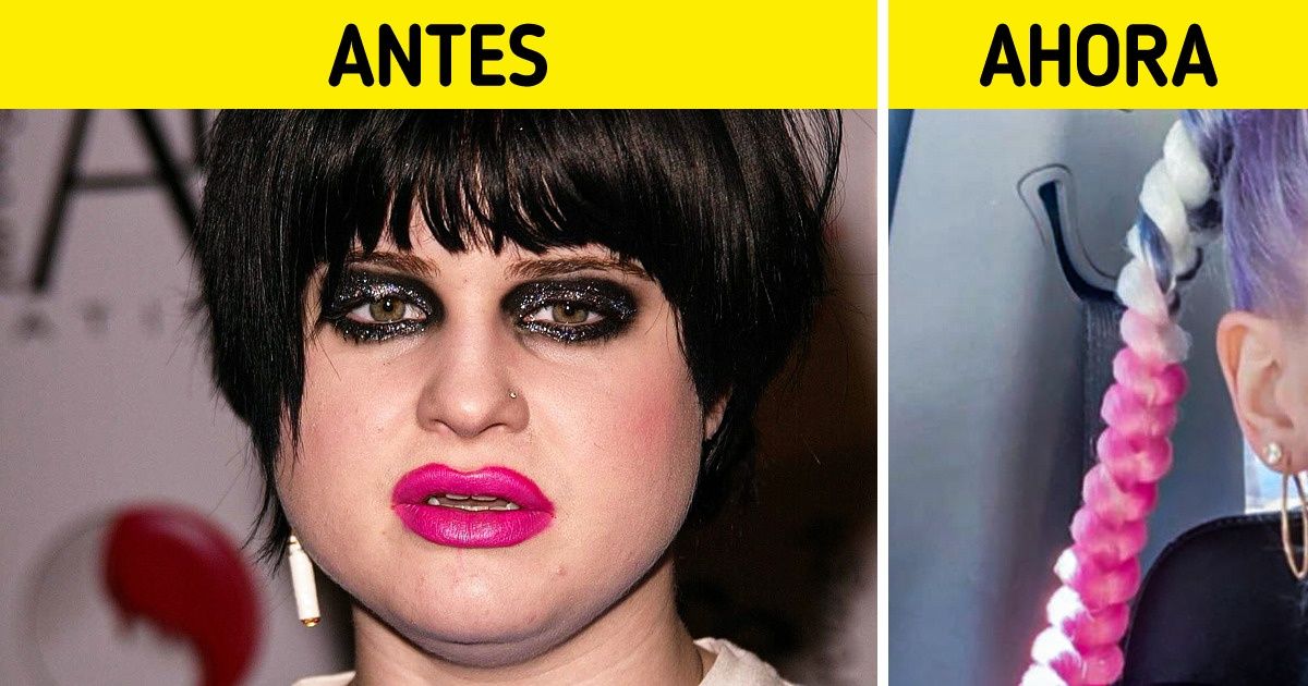 20+ Famosos que tuvieron una transformación radical con el paso del tiempo (algunos lucen mucho mejor ahora) 20+ Famosos que tuvieron una transformación radical con el paso del tiempo (algunos lucen mucho mejor ahora)