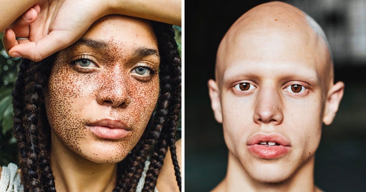 11 Modelos atrevidos que cambiarán los estándares de belleza ahora mismo 11 Modelos atrevidos que cambiarán los estándares de belleza ahora mismo