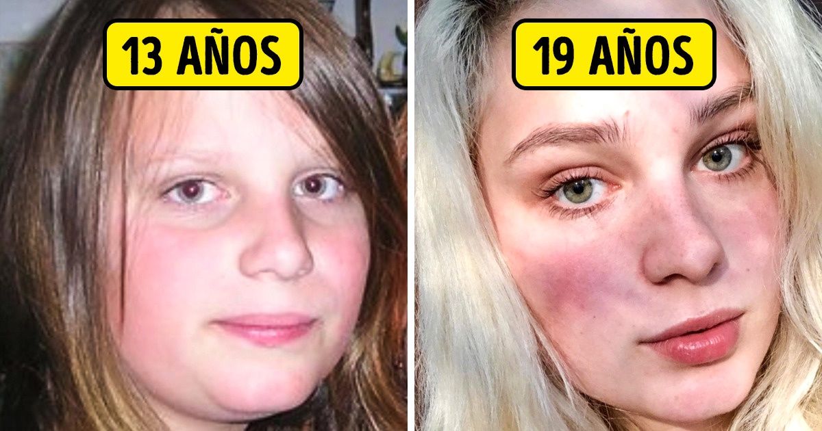 15 Personas que reconocieron que sus preocupaciones por su apariencia en la adolescencia fueron innecesarias 15 Personas que reconocieron que sus preocupaciones por su apariencia en la adolescencia fueron innecesarias