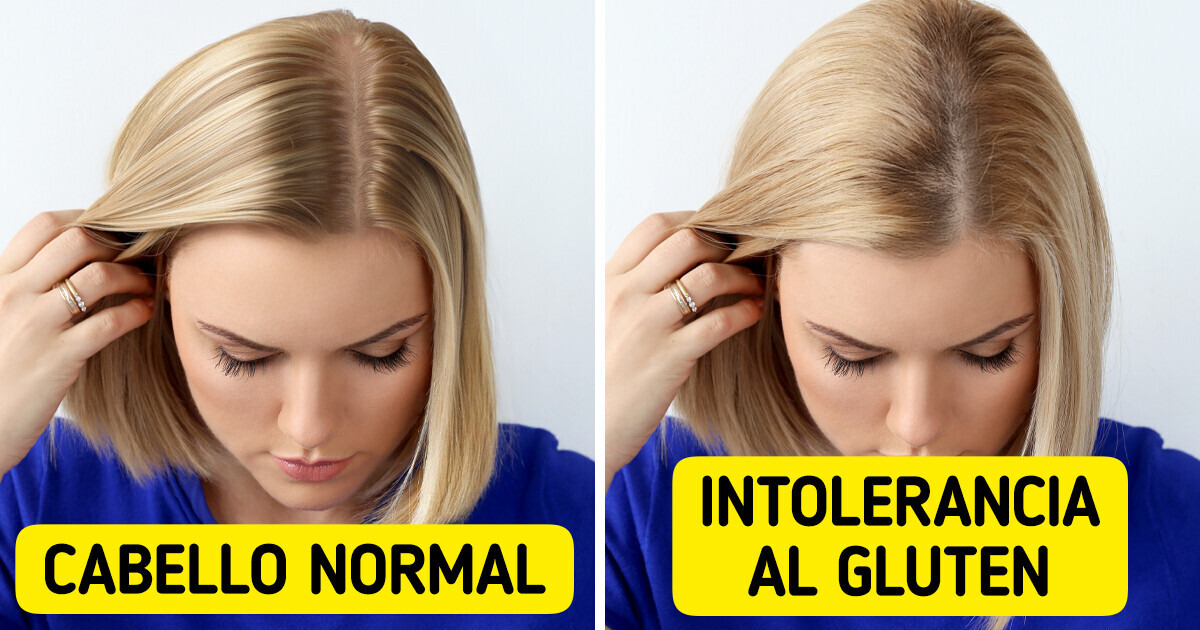 11 Señales inusuales que podrían indicar intolerancia al gluten