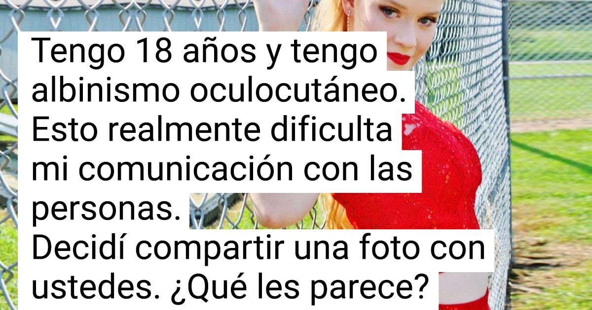 20+ Personas que no necesitan destacar entre la multitud, dado que la naturaleza ya hizo eso por ellas