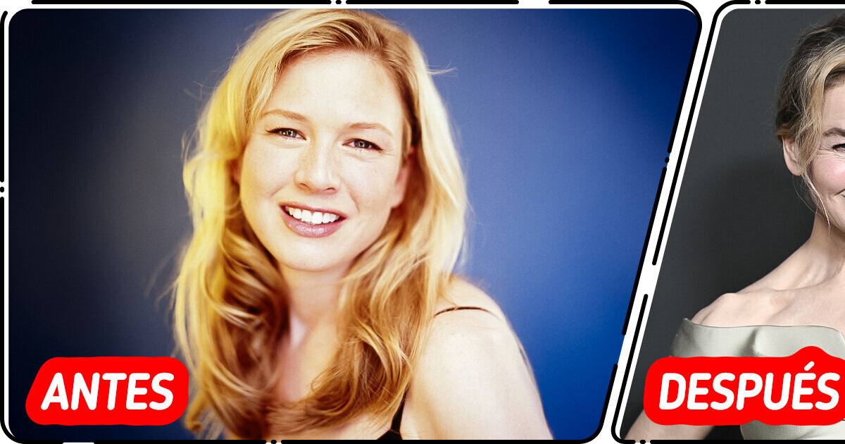 “¿Qué le pasó en los labios?” El nuevo look de Renée Zellweger preocupa a sus fans “¿Qué le pasó en los labios?” El nuevo look de Renée Zellweger preocupa a sus fans