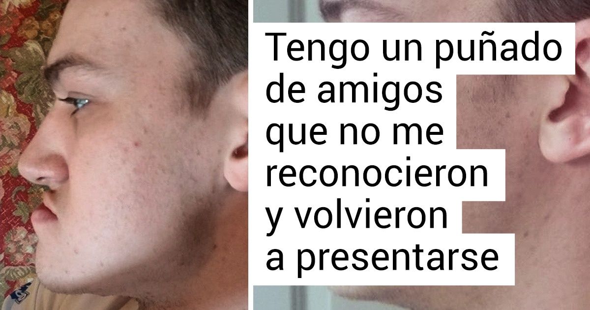 20 Personas que transformaron su rostro y no podrían estar más contentas con el resultado 20 Personas que transformaron su rostro y no podrían estar más contentas con el resultado