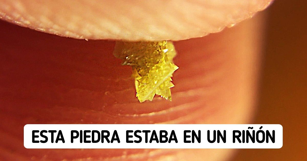 25 Cosas curiosas que pocas personas han visto con sus propios ojos 25 Cosas curiosas que pocas personas han visto con sus propios ojos