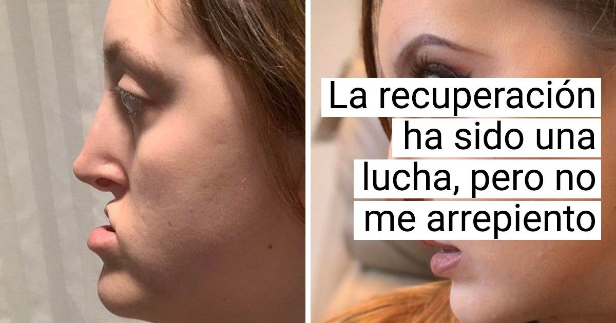 20 Personas que hicieron un cambio en su rostro y parecen alguien diferente