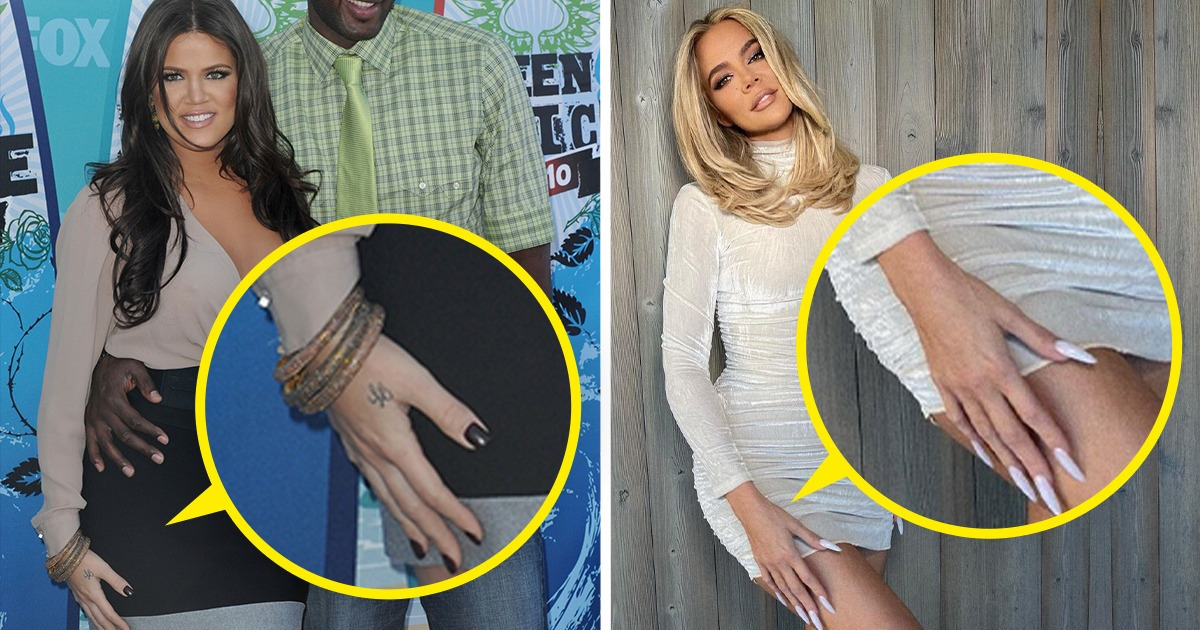 15 Famosos que se arrepintieron de sus tatuajes y corrieron a quitárselos