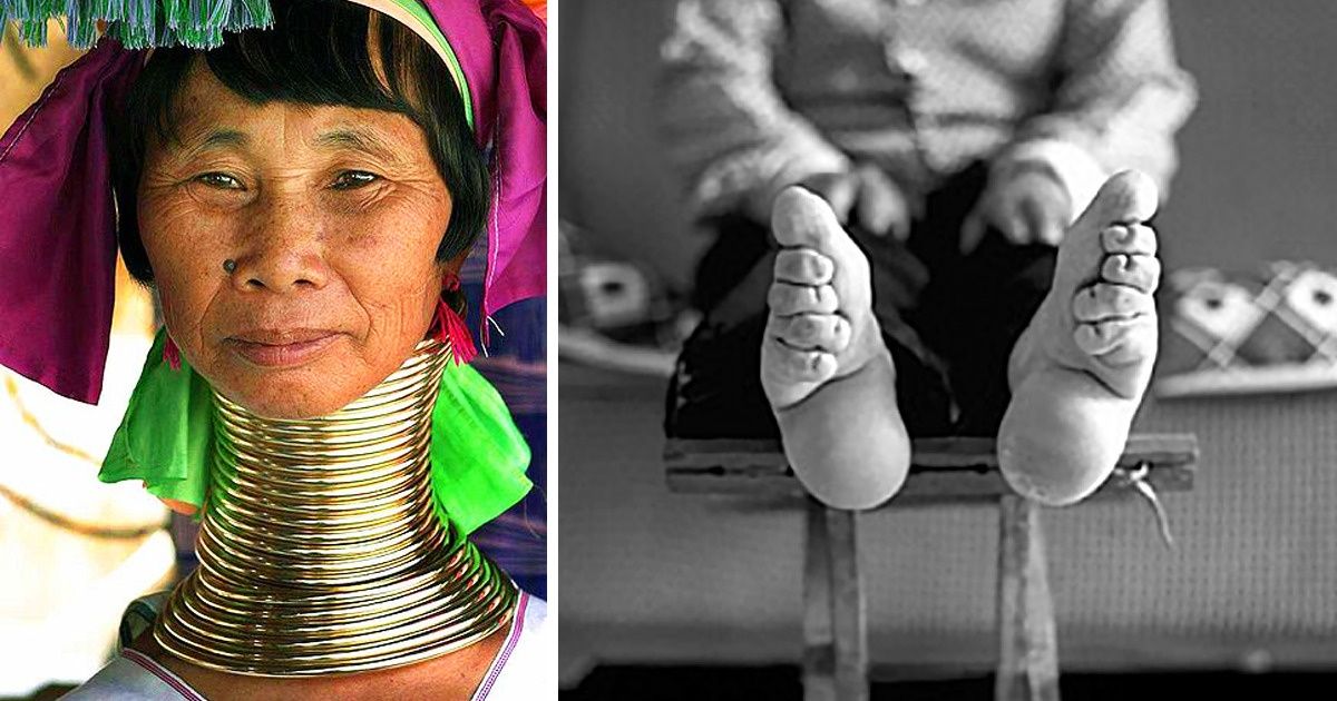 11 Tendencias de belleza y modas peligrosas que la gente solía tener en el pasado 11 Tendencias de belleza y modas peligrosas que la gente solía tener en el pasado