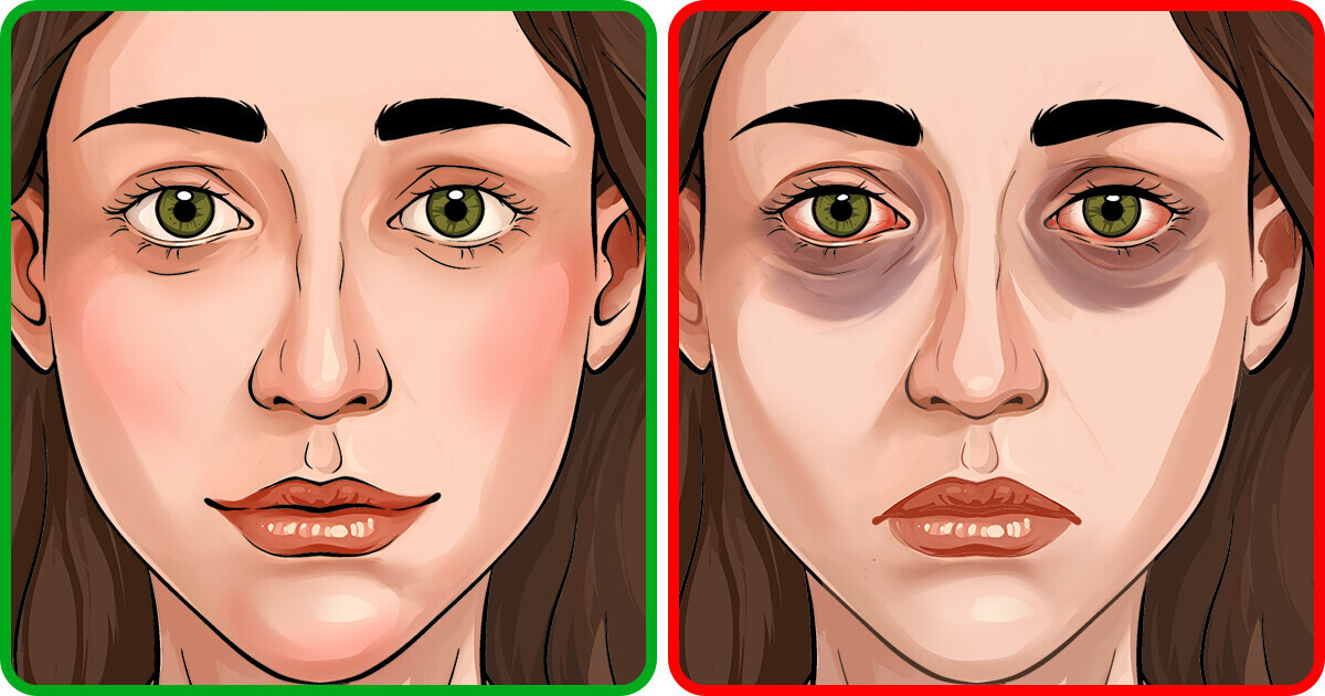 4 Señales de asma que podrías estar pasando por alto sin darte cuenta 4 Señales de asma que podrías estar pasando por alto sin darte cuenta