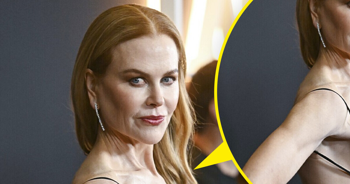 “Se ve patética”, Nicole Kidman, de 57 años, luce atrevido vestido y muchos piensan que es inapropiado para su edad “Se ve patética”, Nicole Kidman, de 57 años, luce atrevido vestido y muchos piensan que es inapropiado para su edad