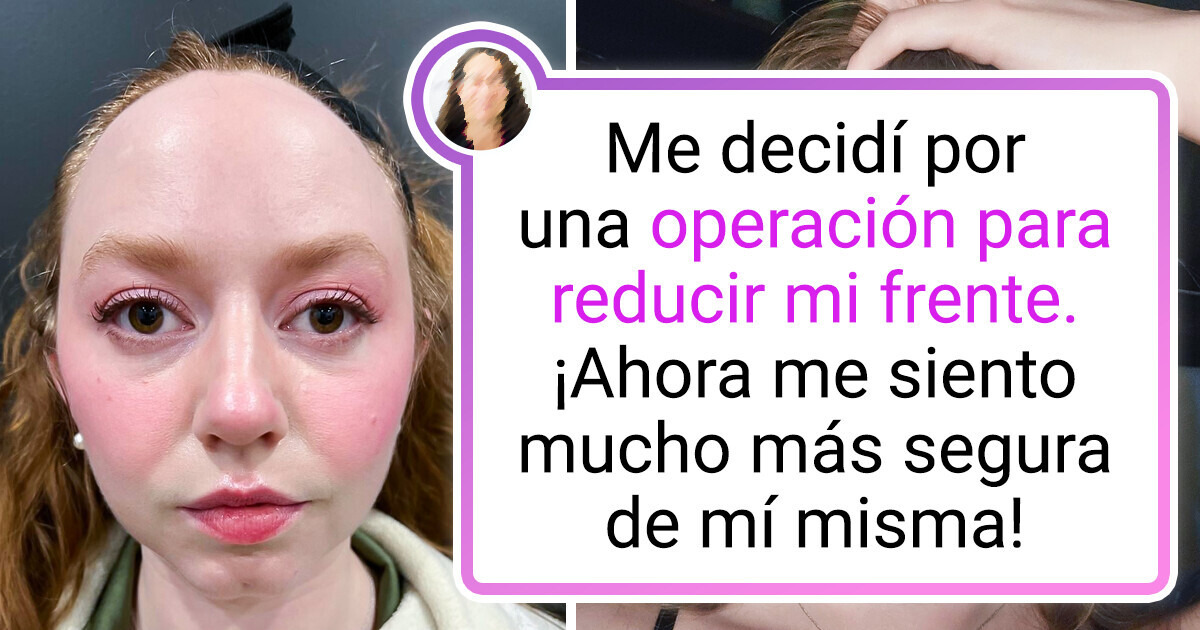 20+ Fotos que muestran claramente lo que significa “una gran diferencia” 20+ Fotos que muestran claramente lo que significa “una gran diferencia”