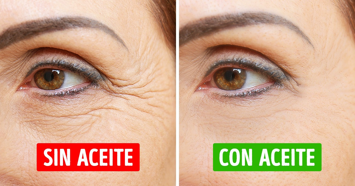 6 Aceites que están listos para pelear contra las arrugas 6 Aceites que están listos para pelear contra las arrugas