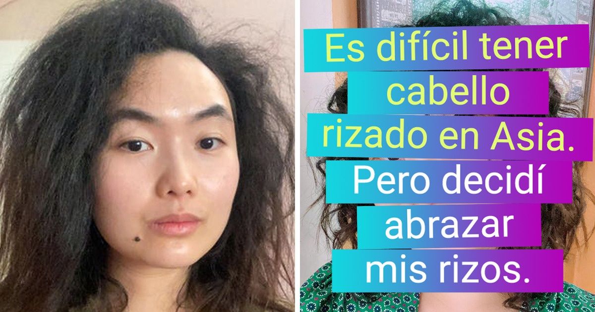 20 Mujeres cuyos “defectos” en realidad son características que las hacen únicas