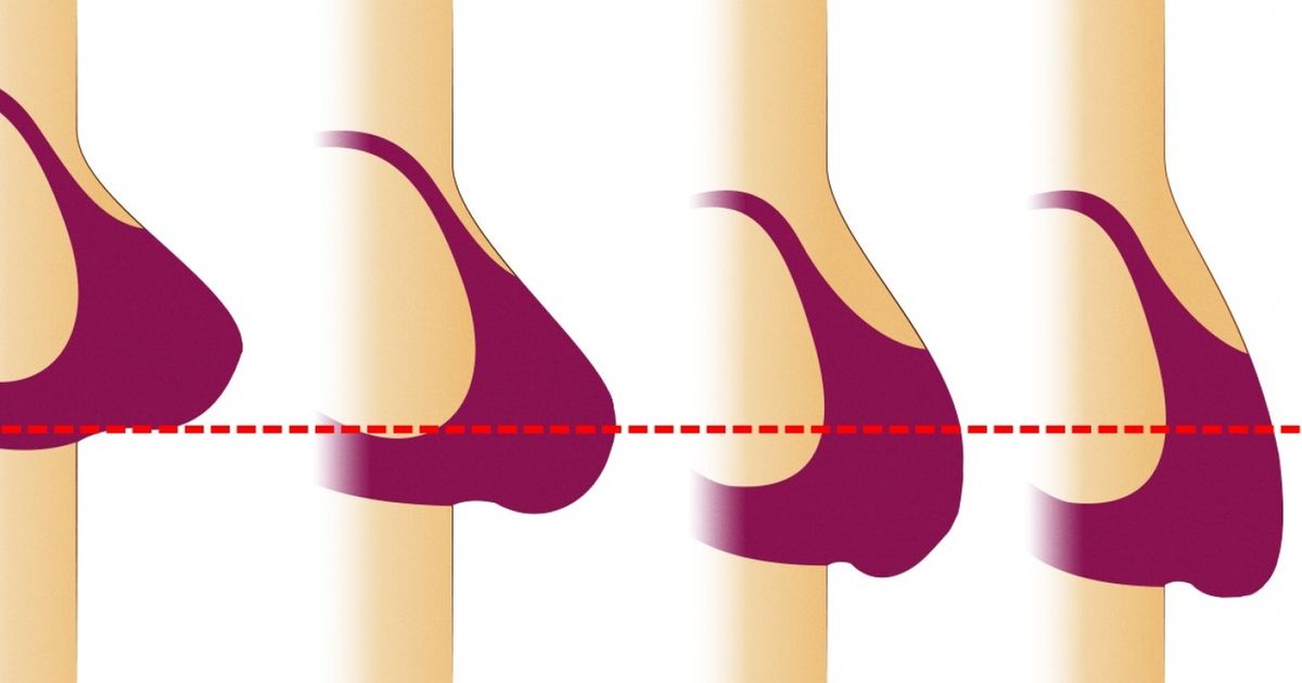 9 Cosas ordinarias que perjudican nuestra belleza 9 Cosas ordinarias que perjudican nuestra belleza