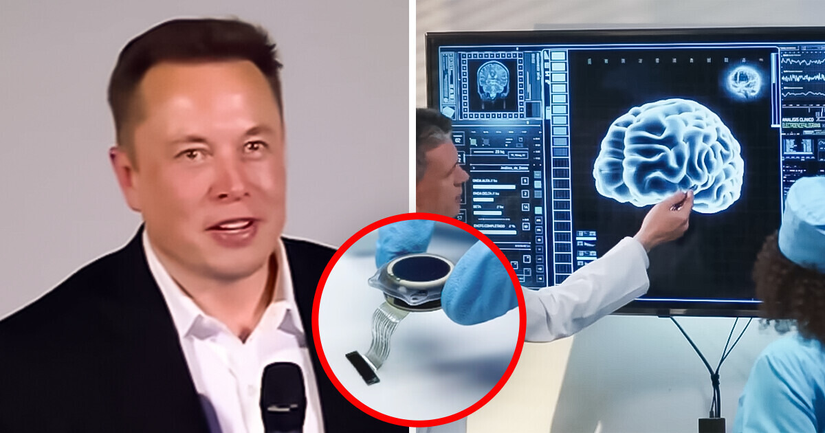 La primera persona con un chip cerebral comienza a mostrar avances y asombra al mundo