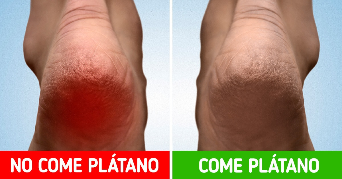 10 Cosas que podrían sucederle a nuestro cuerpo si comemos plátano todos los días
