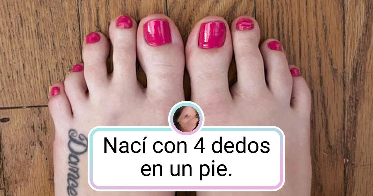 15 Personas extraordinarias que recibieron un regalo inesperado de la madre naturaleza 15 Personas extraordinarias que recibieron un regalo inesperado de la madre naturaleza