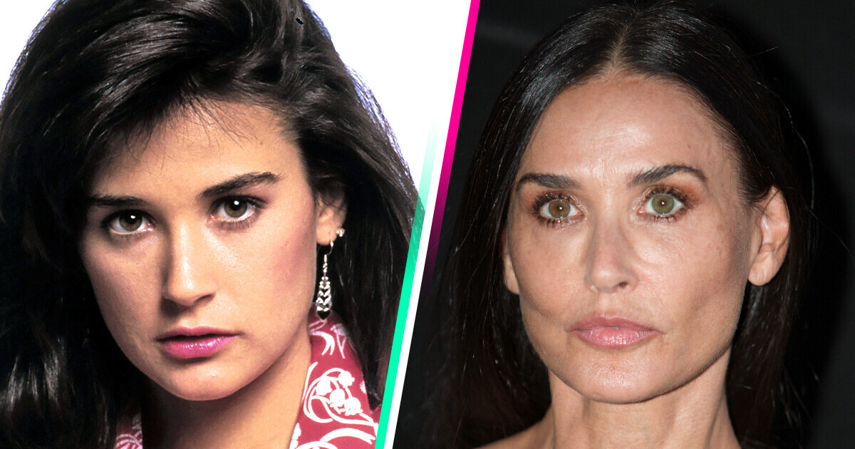 15 Famosas que transformaron sus mejillas y cambiaron drásticamente su rostro 15 Famosas que transformaron sus mejillas y cambiaron drásticamente su rostro