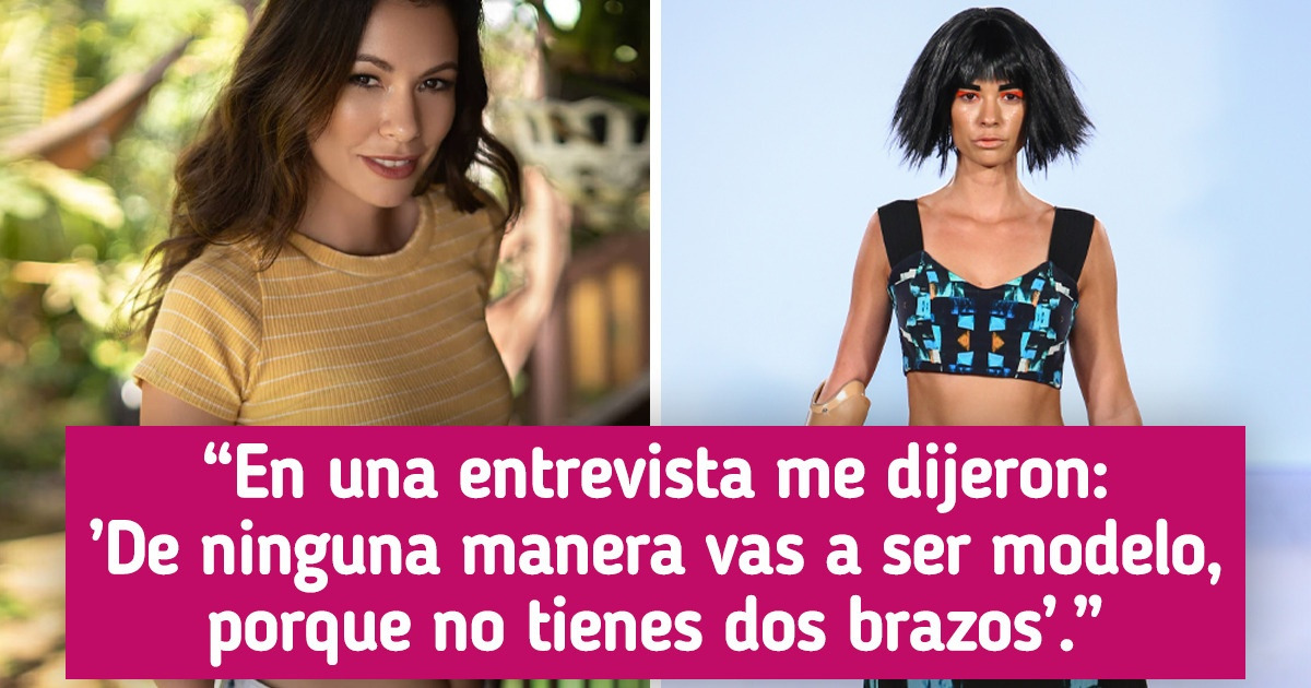 Cómo Shaholly Ayers triunfó en las pasarelas a pesar de haber nacido sin el antebrazo derecho