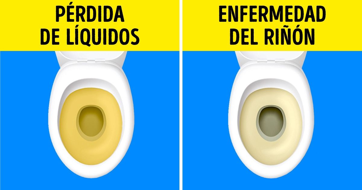7 Señales de que estás comiendo demasiada sal