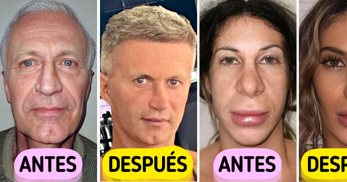 Esta clínica utiliza la proporción áurea para realizar impresionantes transformaciones de cirugía plástica Esta clínica utiliza la proporción áurea para realizar impresionantes transformaciones de cirugía plástica