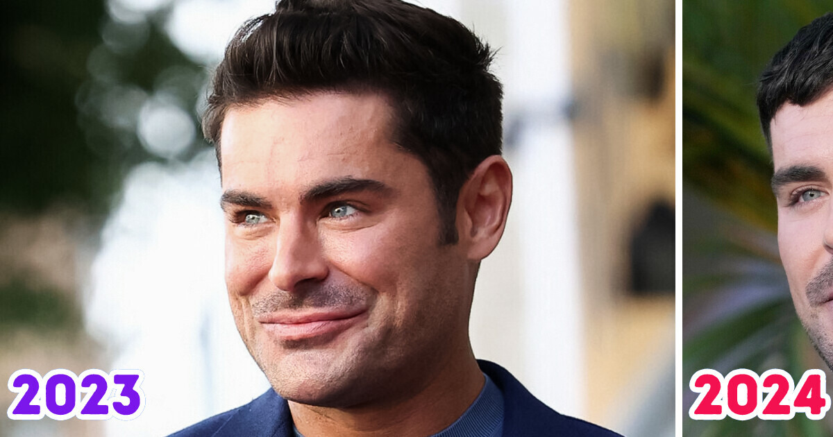 Zac Efron “por fin parece normal” tras una lesión en la barbilla, pero un detalle molesta a los fans Zac Efron “por fin parece normal” tras una lesión en la barbilla, pero un detalle molesta a los fans