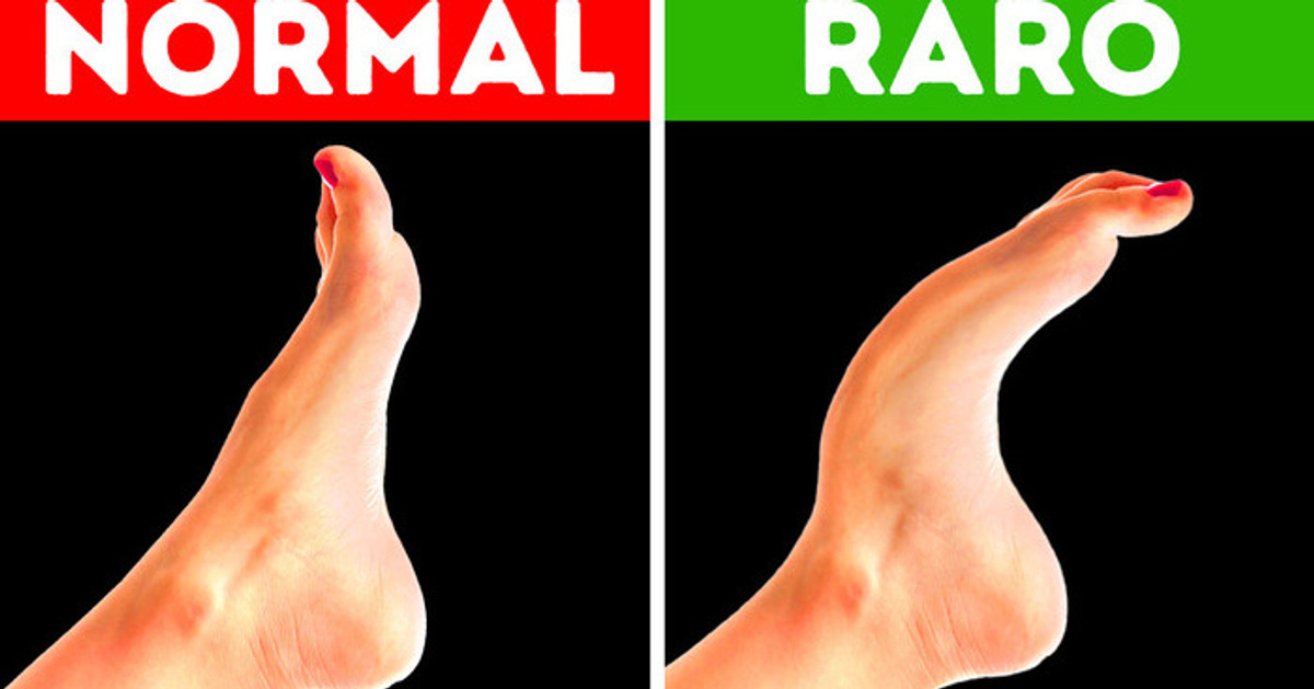 Solo el 8 % de la gente tiene este rasgo corporal + otras 17 características raras