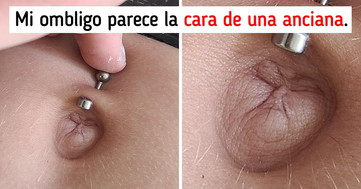 15 Veces en las que los genes hicieron magia con personas y animales