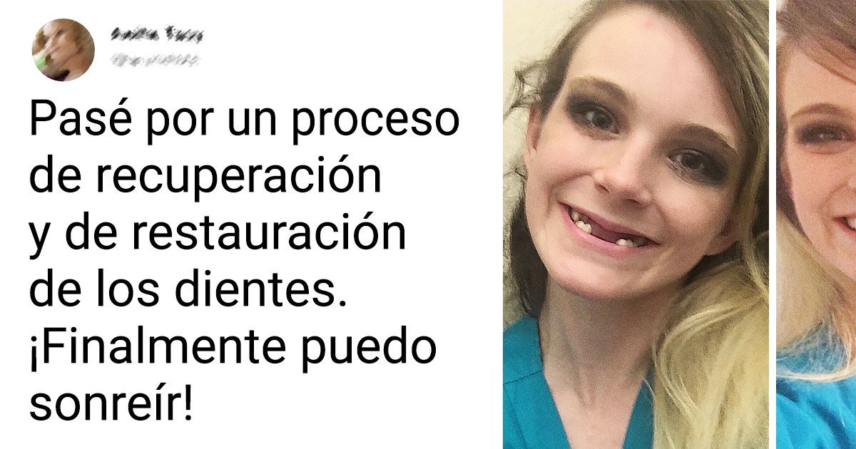 20 Personas que pasaron por el camino más difícil para lograr un cuerpo sano 20 Personas que pasaron por el camino más difícil para lograr un cuerpo sano