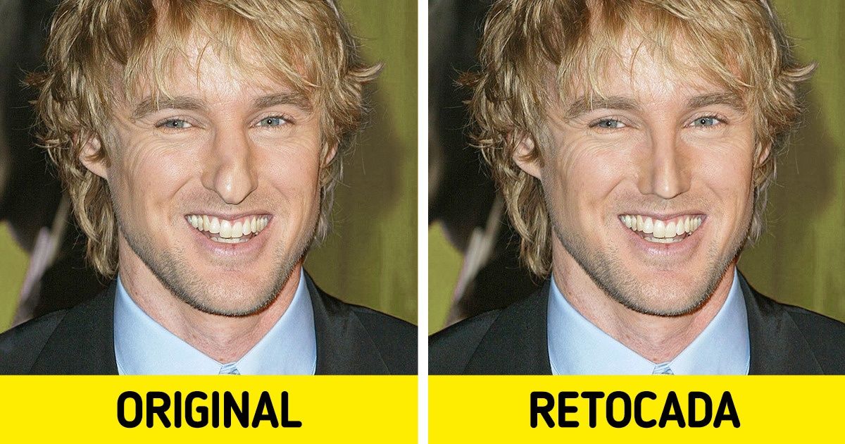 19 Famosos con narices particulares que nos enseñan que los complejos no nos llevan a ningún lado