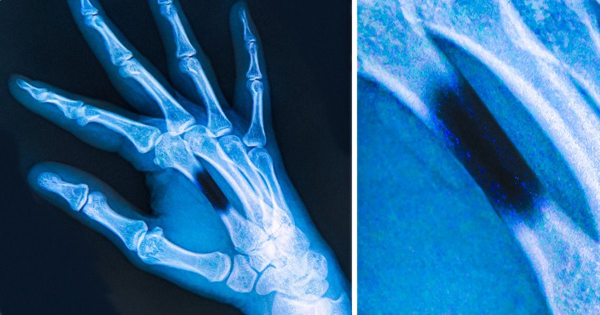 Efectos secundarios impredecibles que pueden producirse tras entrar en contacto con algunos animales Efectos secundarios impredecibles que pueden producirse tras entrar en contacto con algunos animales
