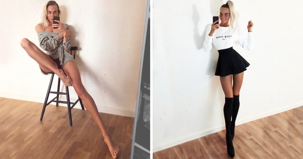 Esta chica sufría de bullying en la escuela. Ahora, aquello de lo que todos se burlaban, la hizo famosa Esta chica sufría de bullying en la escuela. Ahora, aquello de lo que todos se burlaban, la hizo famosa