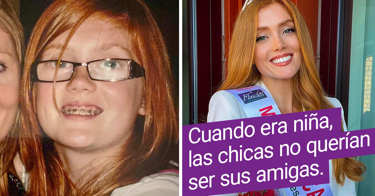 Tras haber sufrido mucho por el color de su cabello, esta mujer se convirtió en la primera Miss Inglaterra pelirroja