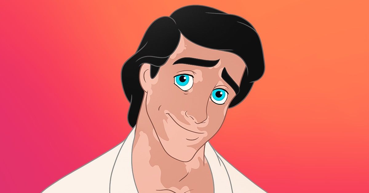 Imaginamos a 15 galanes de Disney con vitíligo, y el resultado podría fortalecer la autoestima de las personas con esta condición Imaginamos a 15 galanes de Disney con vitíligo, y el resultado podría fortalecer la autoestima de las personas con esta condición