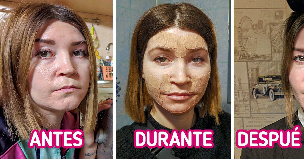 15 Personas que conocen de primera mano lo que pasa en el consultorio de un cosmetólogo 15 Personas que conocen de primera mano lo que pasa en el consultorio de un cosmetólogo