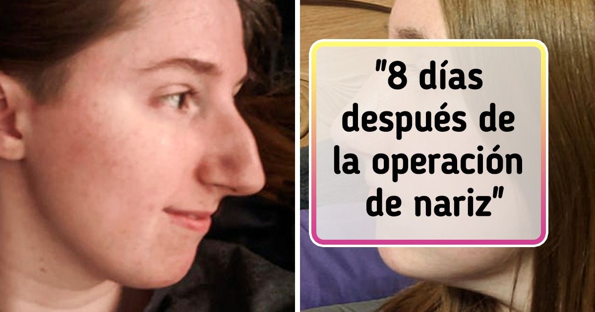 20 Fotos de “antes y después” que muestran el progreso en su forma más pura (nueva selección)