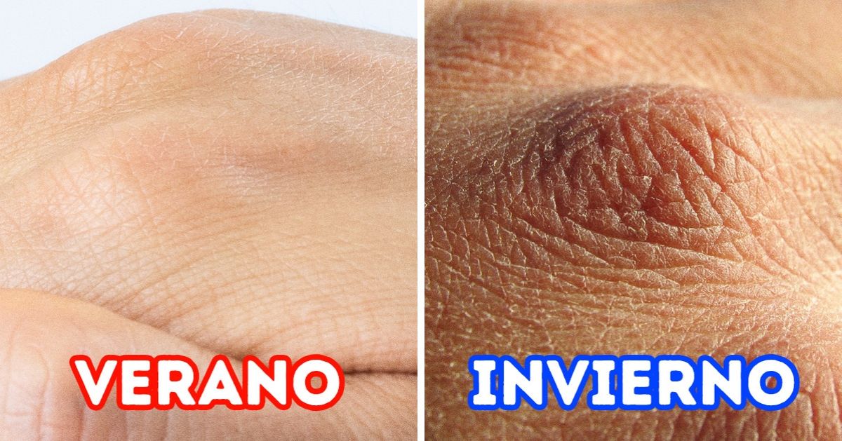 7 Cosas que le pueden pasar a tu cuerpo en invierno 7 Cosas que le pueden pasar a tu cuerpo en invierno