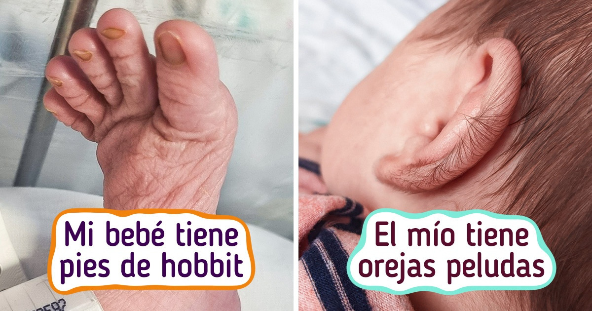17 Bebés que nacieron para sobresalir entre la multitud