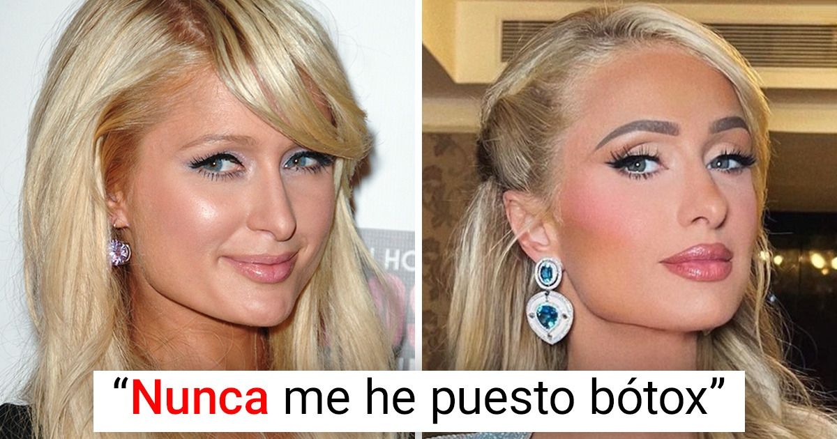 Paris Hilton revela cómo consigue tener un aspecto tan juvenil y natural a sus 41 años Paris Hilton revela cómo consigue tener un aspecto tan juvenil y natural a sus 41 años