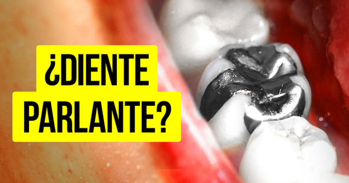 Esta mujer escuchaba señales de radio a través de su diente