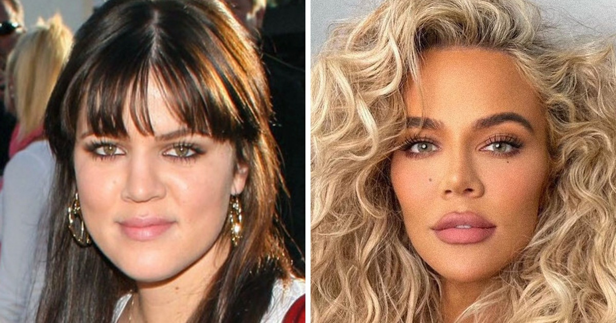 15+ Famosos cuyas transformaciones de imagen nunca dejan de sorprendernos 15+ Famosos cuyas transformaciones de imagen nunca dejan de sorprendernos