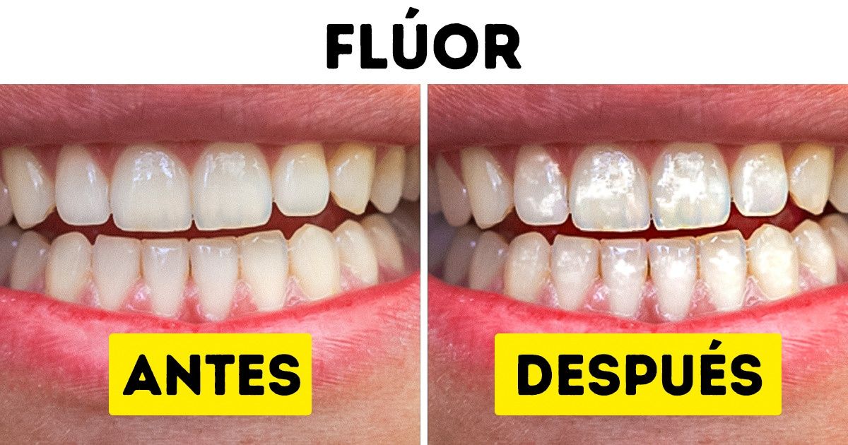 10 Productos populares que causan un daño irreparable a tus dientes 10 Productos populares que causan un daño irreparable a tus dientes