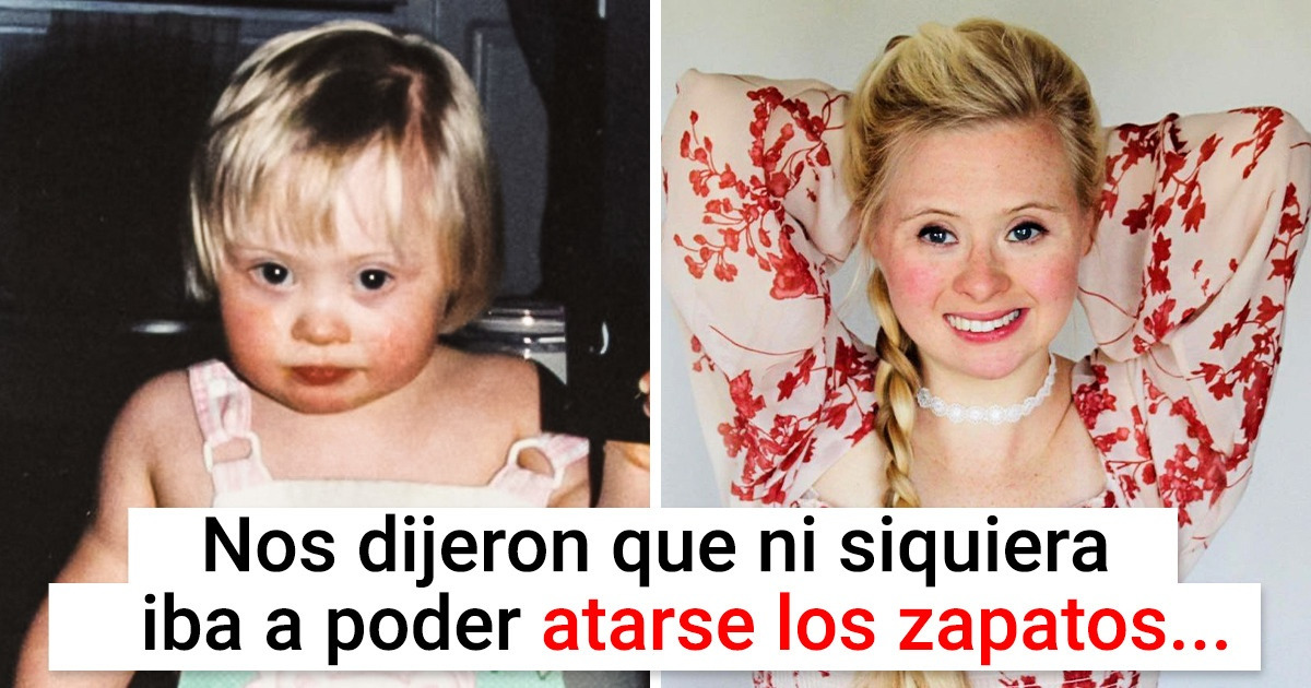 Cómo una joven logró transformar su lucha contra los estereotipos en una misión para ayudar a los demás Cómo una joven logró transformar su lucha contra los estereotipos en una misión para ayudar a los demás