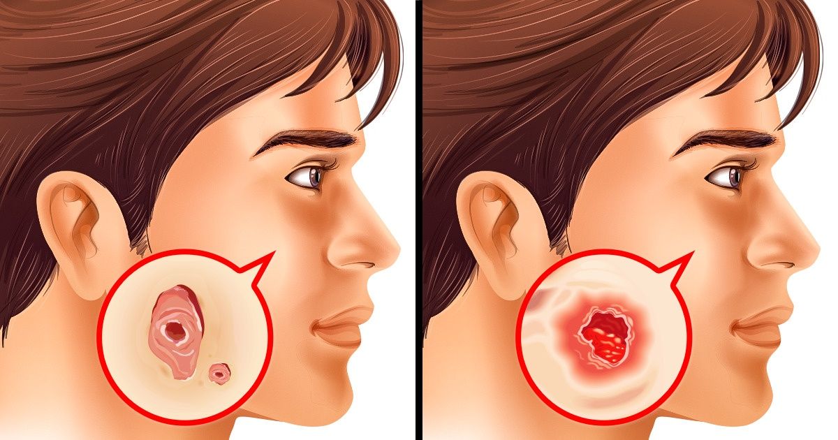 7 Exámenes médicos que todo adulto debe hacerse para prevenir enfermedades graves