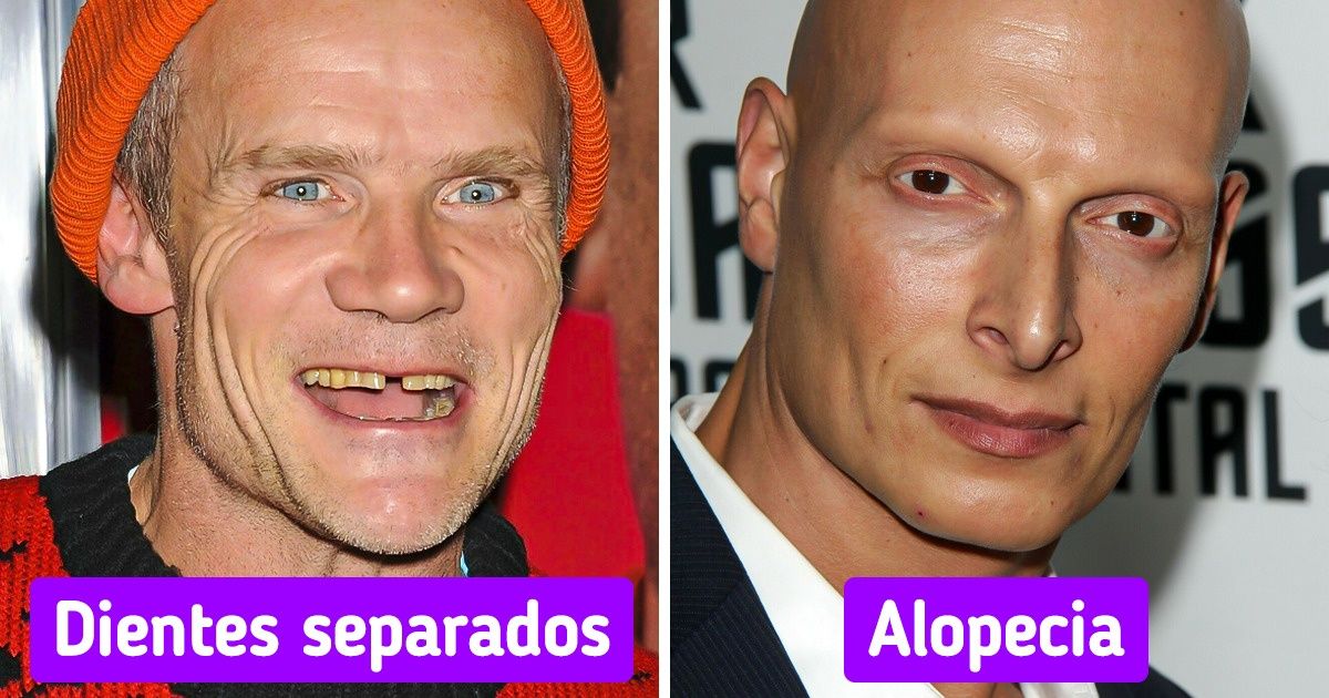 19 Famosos con atributos físicos diferentes que los hacen únicos a pesar de no cumplir con el estándar de belleza convencional 19 Famosos con atributos físicos diferentes que los hacen únicos a pesar de no cumplir con el estándar de belleza convencional